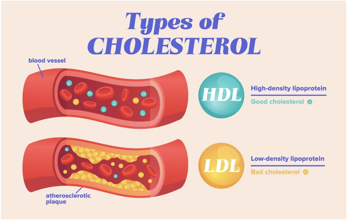 Classification of cholesterol