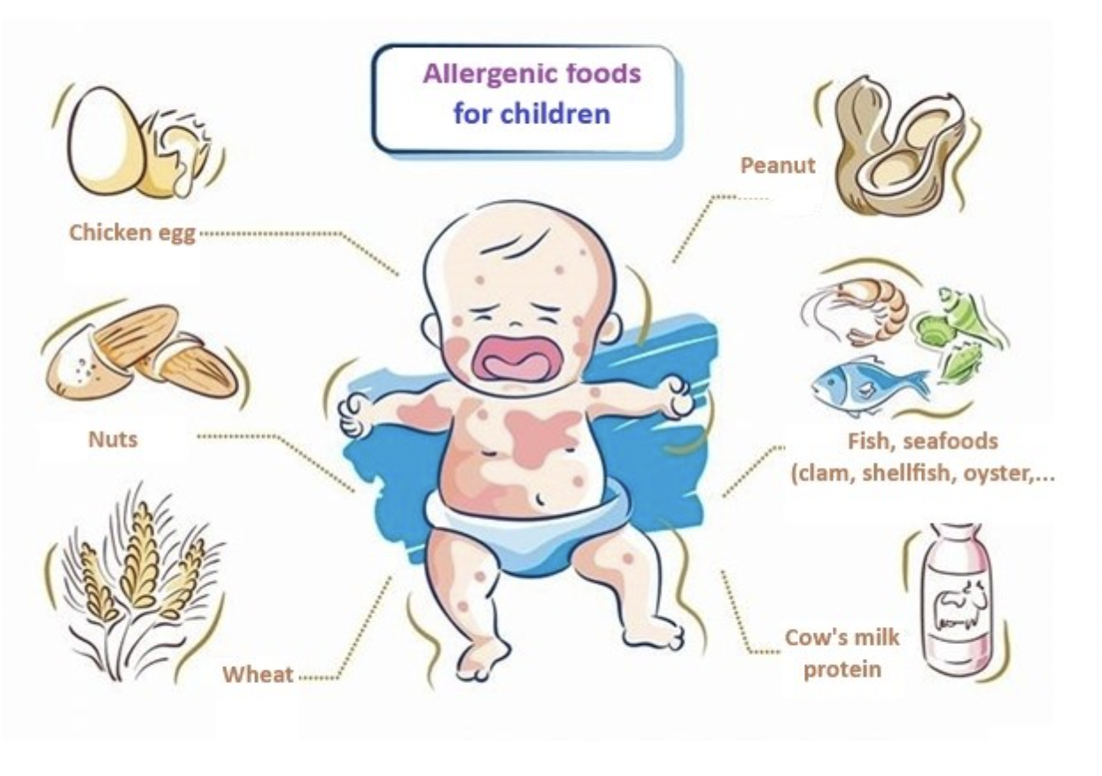 The common allergenic foods for children