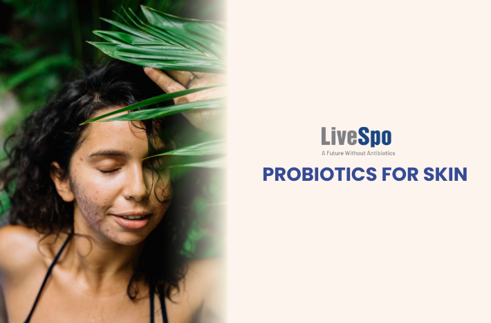 Probiotics for Skin